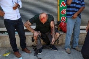A wounded man pauses following an explosion in Suruc in south-eastern Sanliurfa province, Turkey (Photo: Reuters)